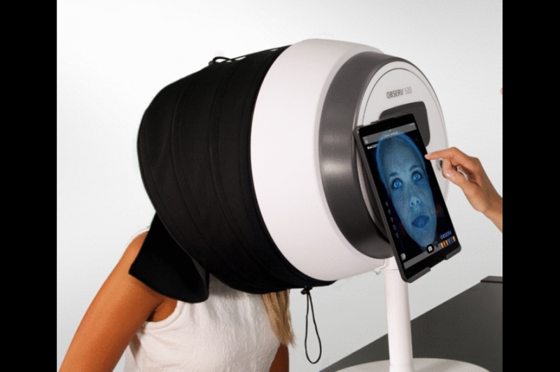 laser hair removal