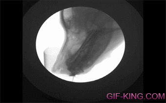 X-ray Video Of A Dog Drinking