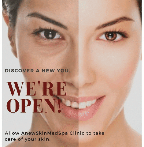 laser hair removal